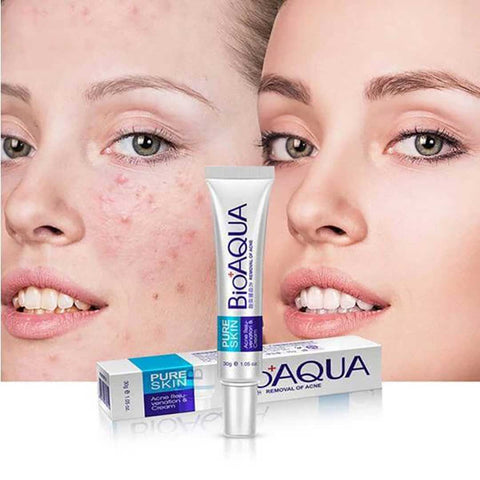 Pure Skin Acne Removal Face Treatment & Rejuvenation Cream (30g) by BIOAQUA