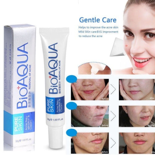 BIOAQUA Pure Skin Acne Removal Face Cream 30g