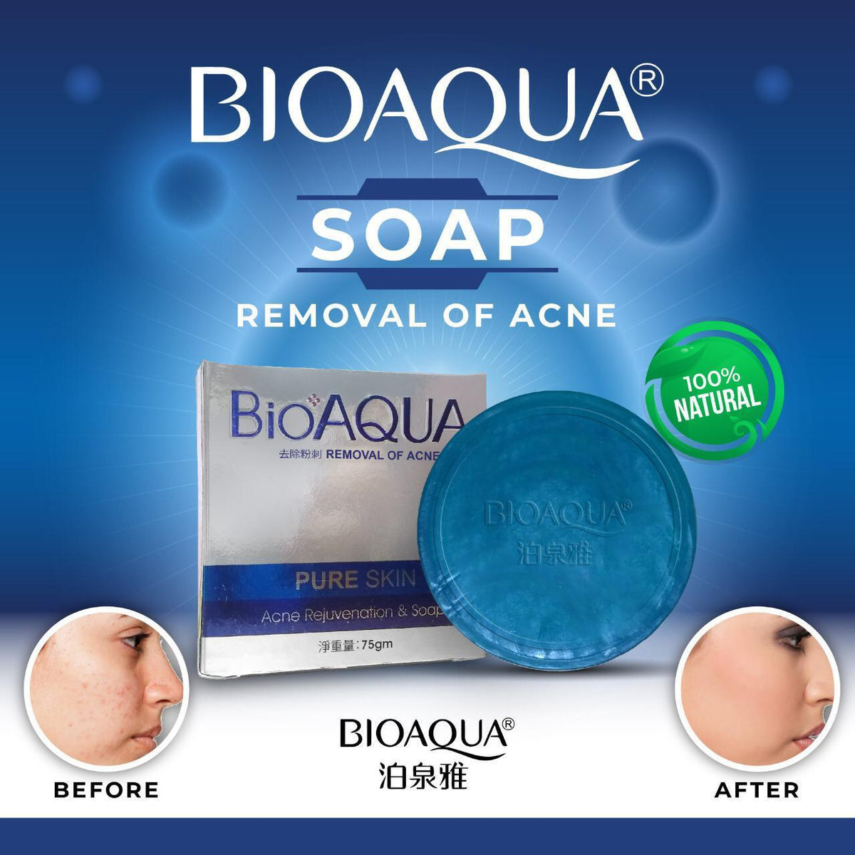 Bioaqua Acne Soap
